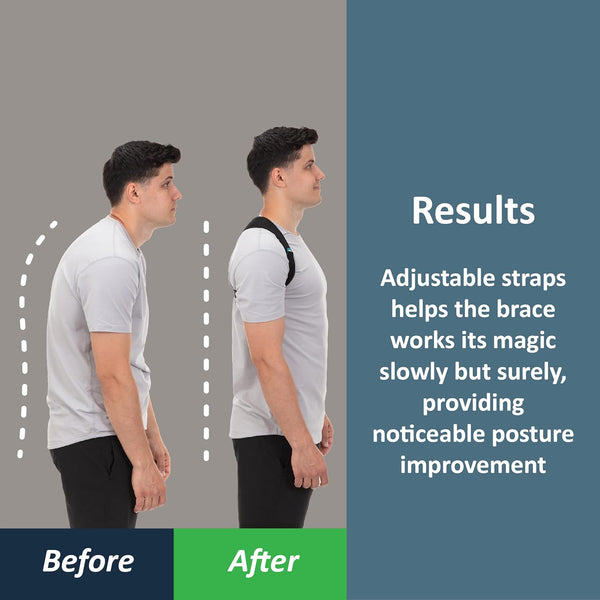Solvix™ Smart Posture Corrector Wearable